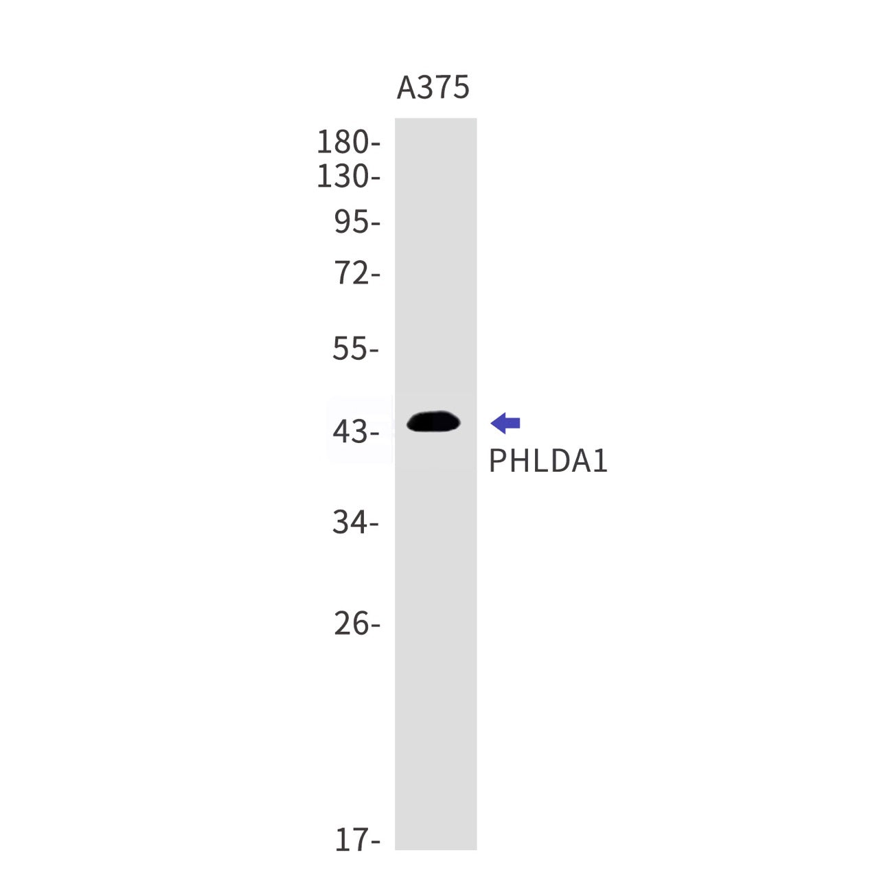 PHLDA1 (11J6) Rabbit Monoclonal Antibody