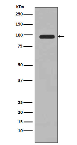 PI 3 Kinase Class 3 (11Y1) Rabbit Monoclonal Antibody