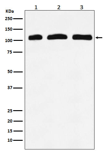 PI 3 Kinase p110 delta (1X2) Rabbit Monoclonal Antibody