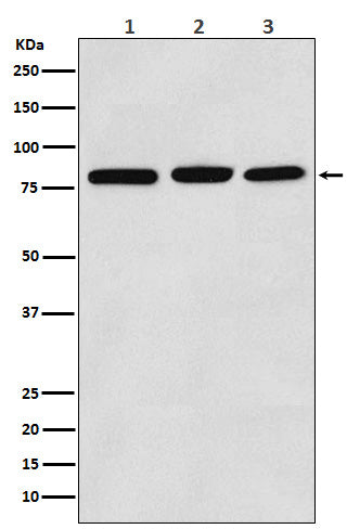 PI3 Kinase p85 alpha (4H15) Rabbit Monoclonal Antibody
