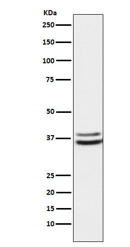 PIM2 (17I7) Rabbit Monoclonal Antibody