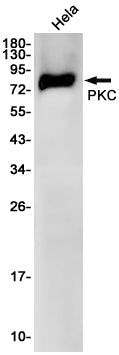 PKC (12X1) Rabbit Monoclonal Antibody