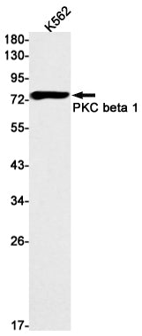PKC beta 2 (12R10) Rabbit Monoclonal Antibody