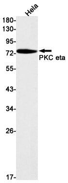 PKC eta (12A9) Rabbit Monoclonal Antibody
