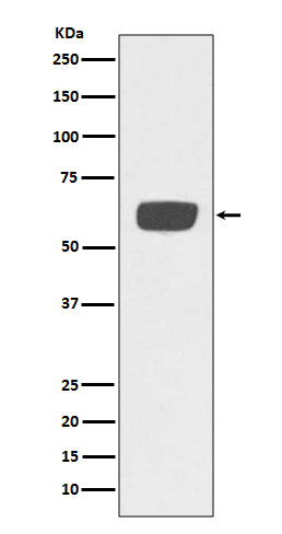 PLAT (12E12) Rabbit Monoclonal Antibody