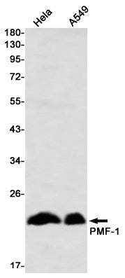 PMF1 (19K12) Rabbit Monoclonal Antibody