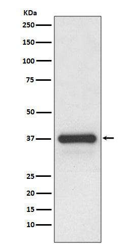 Podoplanin (11C17) Rabbit Monoclonal Antibody