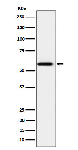 PPAR gamma (19L6) Rabbit Monoclonal Antibody
