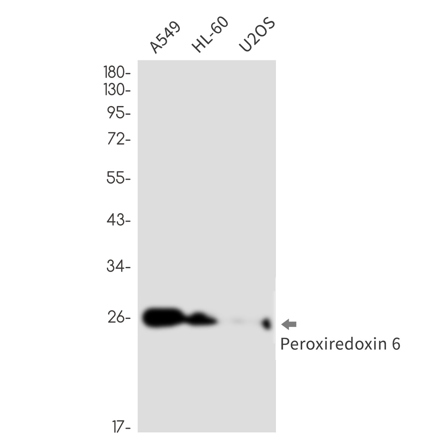 PRDX6 (10R16) Rabbit Monoclonal Antibody