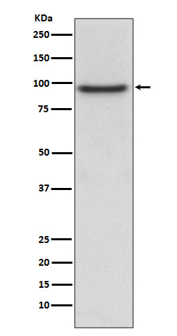PROX1 (11X14) Rabbit Monoclonal Antibody