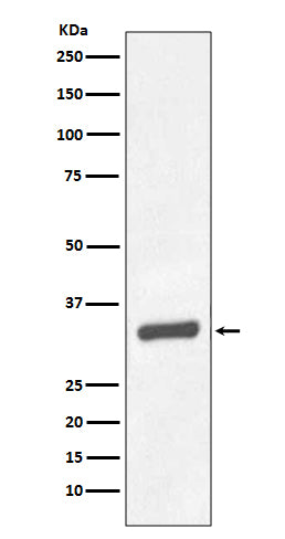 PSA/KLK3 (9M11) Rabbit Monoclonal Antibody