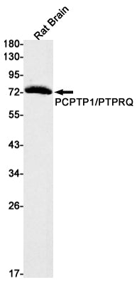 PTPRR (17O4) Rabbit Monoclonal Antibody