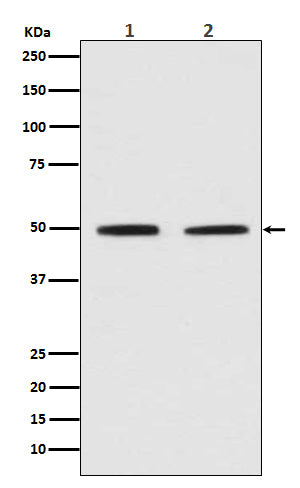 Pygopus 2 (14L2) Rabbit Monoclonal Antibody