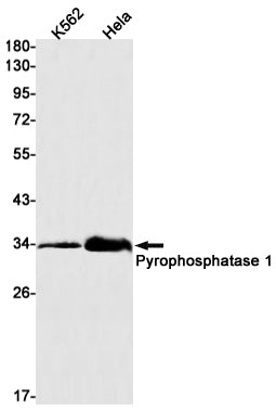 Pyrophosphatase 1 (12N2) Rabbit Monoclonal Antibody