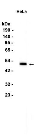 RAD52 (13D10) Rabbit Monoclonal Antibody