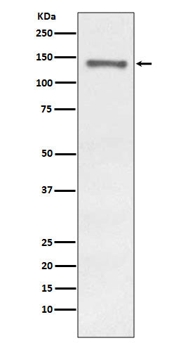 Raptor (10I12) Rabbit Monoclonal Antibody