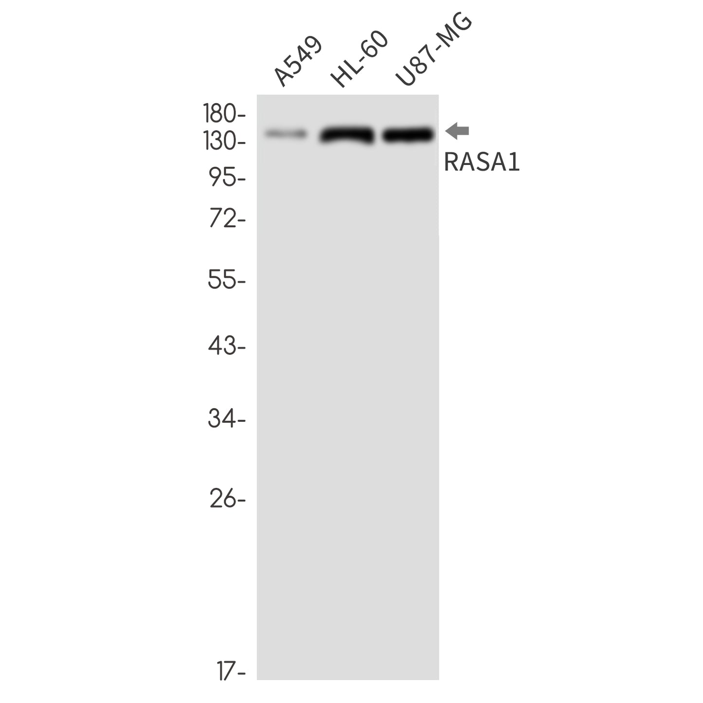 RASA1 (10P8) Rabbit Monoclonal Antibody