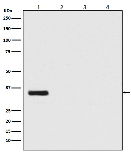 Renilla Luciferase (18F5) Rabbit Monoclonal Antibody