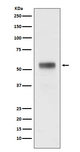 Retinoic Acid Receptor alpha (12V14) Rabbit Monoclonal Antibody