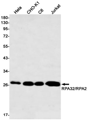RFA2 (1I7) Rabbit Monoclonal Antibody