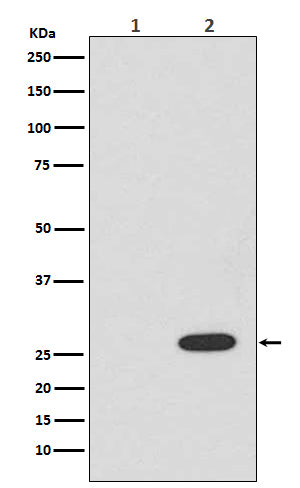 RFP (14R10) Rabbit Monoclonal Antibody