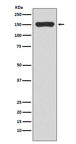 RNA polymerase beta (10U4) Rabbit Monoclonal Antibody