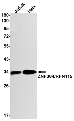 RNF115 (10R4) Rabbit Monoclonal Antibody