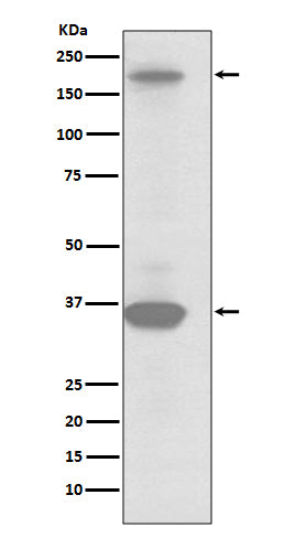 RON (15C9) Rabbit Monoclonal Antibody