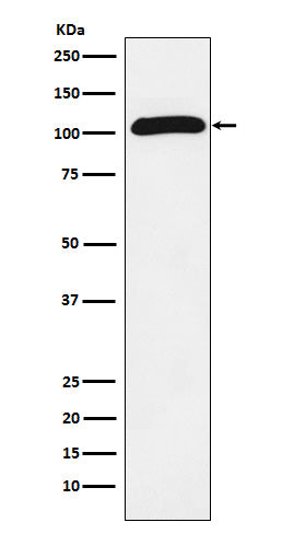 ROR2 (9T12) Rabbit Monoclonal Antibody