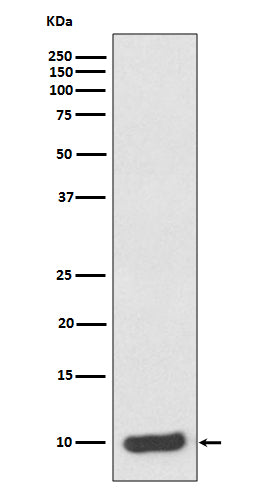 S100 alpha 6 (12M1) Rabbit Monoclonal Antibody