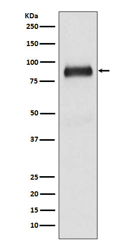 SATB2 (16T7) Rabbit Monoclonal Antibody