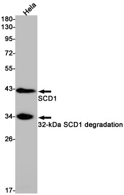 SCD1 (2W16) Rabbit Monoclonal Antibody