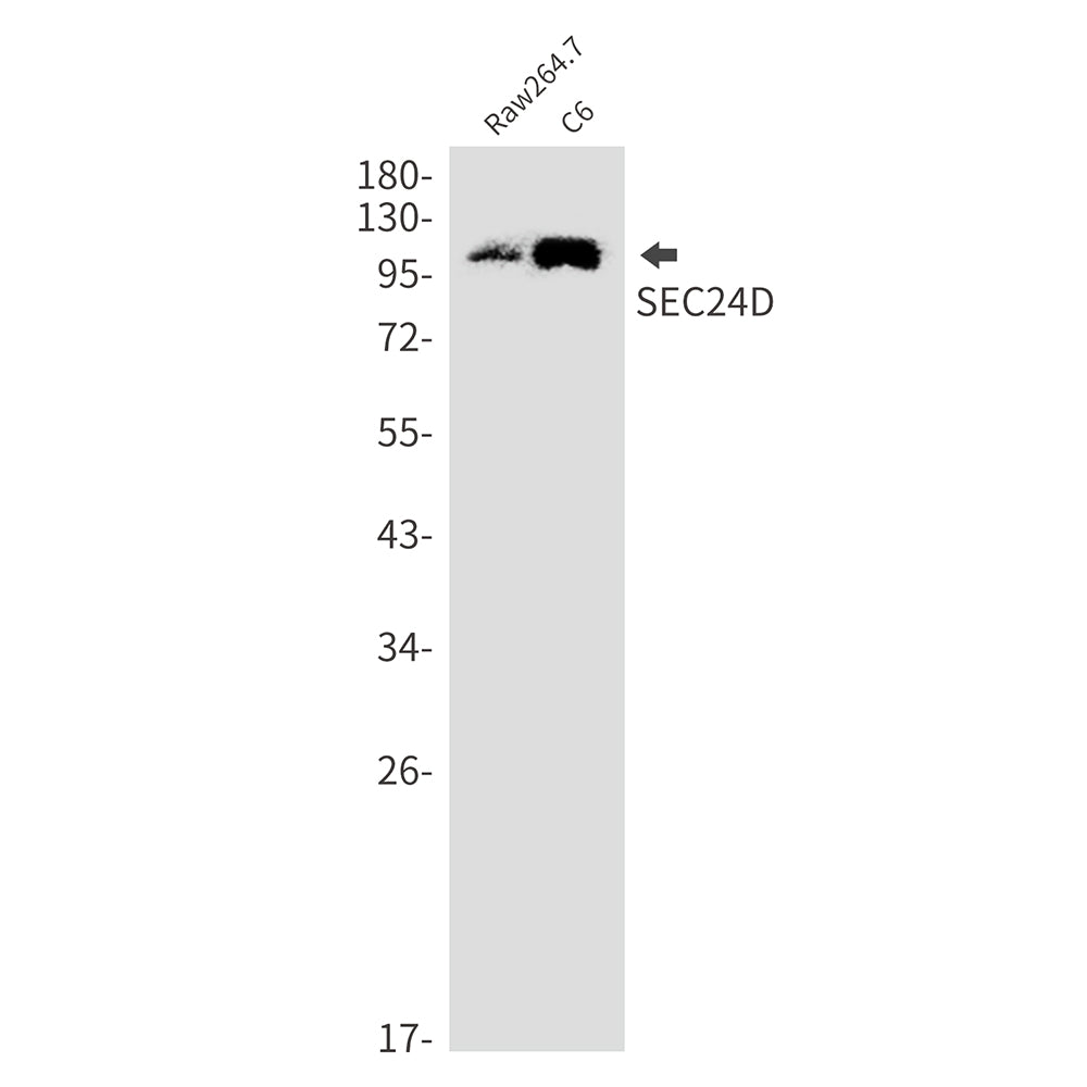 SEC24D (8B14) Rabbit Monoclonal Antibody