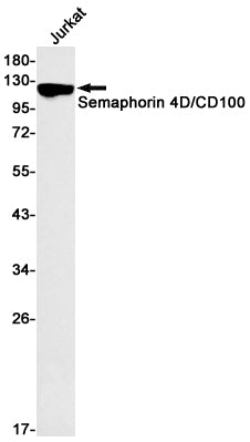 Semaphorin 4D / CD100 (13A9) Rabbit Monoclonal Antibody