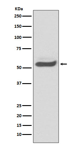 SERPINA1 (2F7) Rabbit Monoclonal Antibody