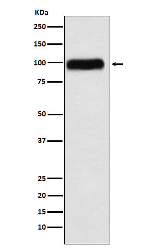 SERPING1 (12Y5) Rabbit Monoclonal Antibody