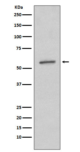SGK1 (12S19) Rabbit Monoclonal Antibody