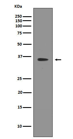 SIRT2 (7W12) Rabbit Monoclonal Antibody