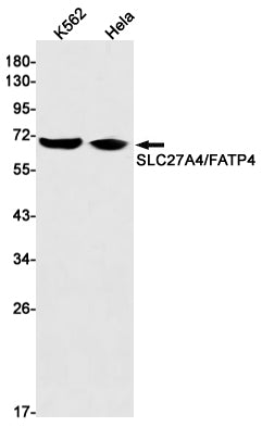 SLC27A4 (1C18) Rabbit Monoclonal Antibody