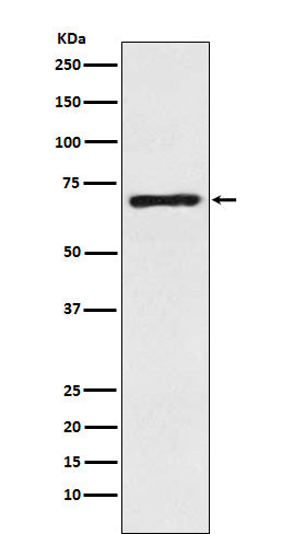 SLC6A1 / GAT1 (9T4) Rabbit Monoclonal Antibody