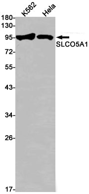 SLCO5A1 (6J8) Rabbit Monoclonal Antibody