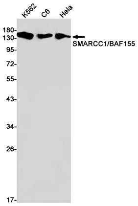 SMARCC1/BAF155 (11P17) Rabbit Monoclonal Antibody