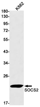 SOCS2 (3T6) Rabbit Monoclonal Antibody