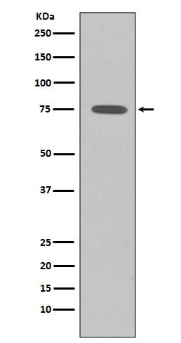 Somatostatin Receptor 2 (8M8) Rabbit Monoclonal Antibody