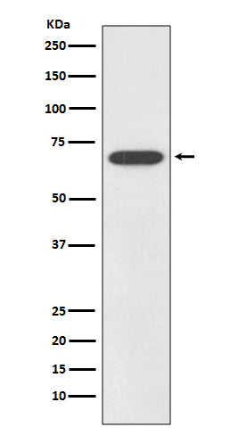 SOX11 (12Z19) Rabbit Monoclonal Antibody