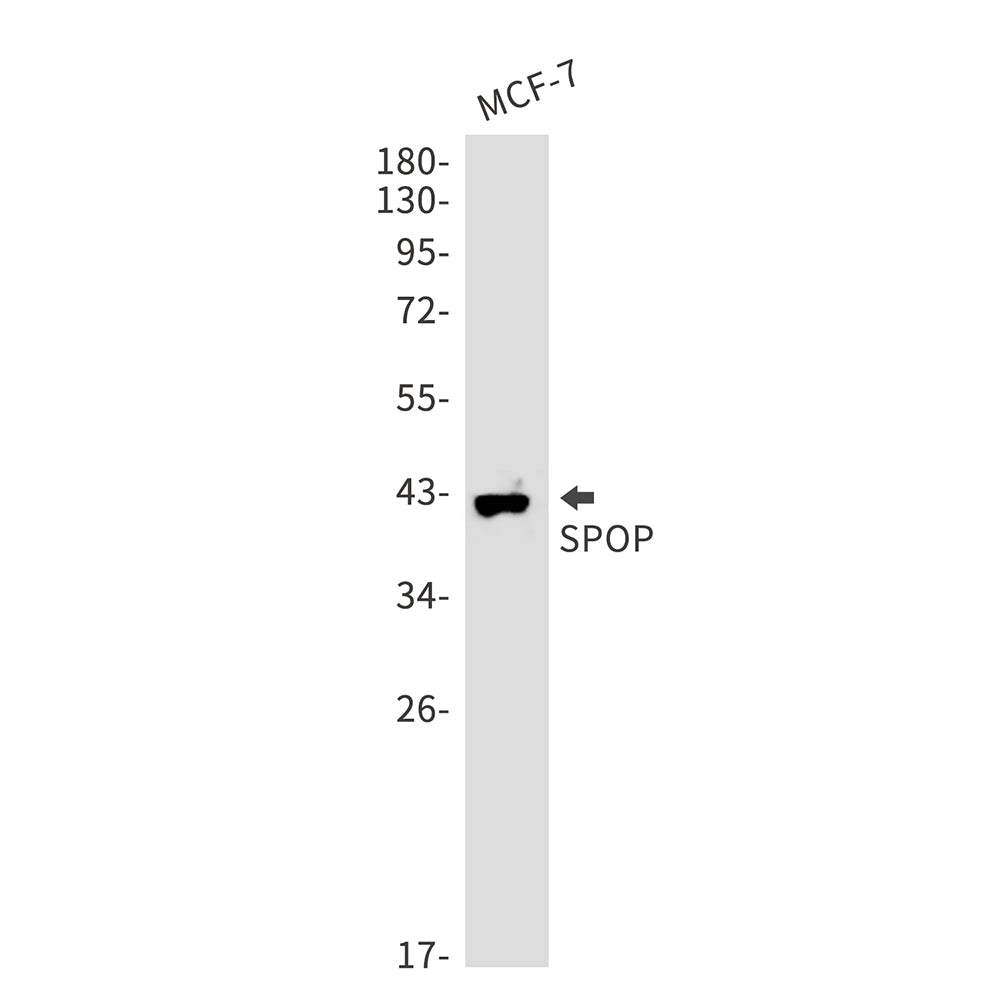 SPOP (2B14) Rabbit Monoclonal Antibody
