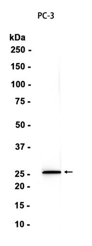 SRD5A2 (14R3) Rabbit Monoclonal Antibody