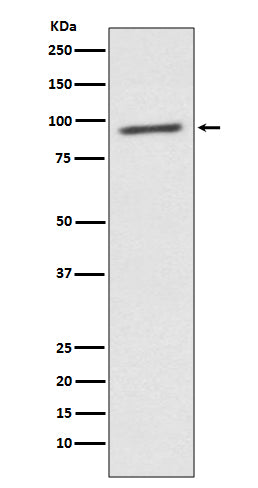 STAT2 (5I18) Rabbit Monoclonal Antibody