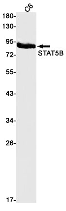 STAT5A/B (8D5) Rabbit Monoclonal Antibody