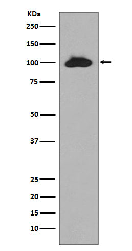 STAT6 (12B11) Rabbit Monoclonal Antibody